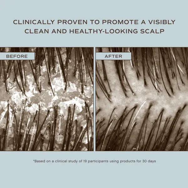Hair Renew Scalp Hairbath
